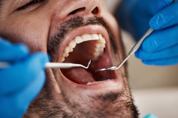 Best Broken or Cracked Tooth Emergency Dentist in Lake Alfred, FL
