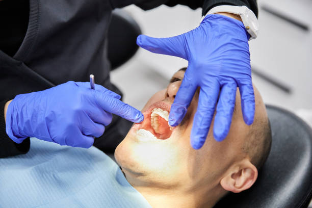Best Emergency Dentist for Lost Fillings or Crowns in Lake Alfred, FL